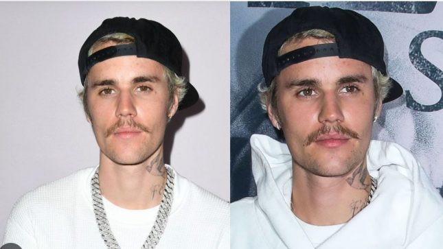 Justin Bieber Has Revealed He is suffering from Facial Paralysis